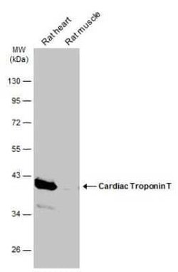 Cardiac Troponin T Antibody, Novus Biologicals 100 &mu;g | Buy Online | Bio-Techne | Fisher Scientific