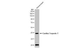 Cardiac Troponin T Antibody, Novus Biologicals 100 &mu;g | Buy Online | Bio-Techne | Fisher Scientific