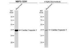 Cardiac Troponin T Antibody, Novus Biologicals 100 &mu;g | Buy Online | Bio-Techne | Fisher Scientific
