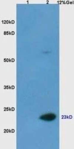 Casein Antibody, Novus Biologicals 200 μg; Unconjugated:Antibodies,