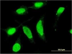 Casein Kinase 1 delta Antibody (4H8), Novus Biologicals 0.1 mg | Buy Online | Novus Biologicals | Fisher Scientific