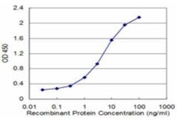 Casein Kinase 1 gamma 2 Antibody (2F5), Novus Biologicals 0.1 mg | Buy Online | Novus Biologicals | Fisher Scientific