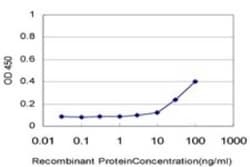Casein Kinase 2 alpha Antibody (3D9), Novus Biologicals 0.1 mg, Unconjugated:Antibodies,
