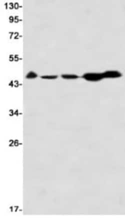 Casein Kinase 2 alpha Antibody (S05-7F8), Novus Biologicals:Antibodies:Primary