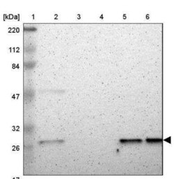Casein Kinase 2 beta Antibody, Novus Biologicals 25 &mu;L | Buy Online | Novus Biologicals | Fisher Scientific