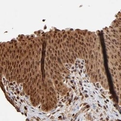 Caspase-1 Antibody, Novus Biologicals:Antibodies:Primary Antibodies