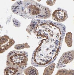 Caspase-3 Antibody, Novus Biologicals 25 &mu;L | Buy Online | Novus Biologicals | Fisher Scientific