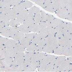 Caspase-3 Antibody, Novus Biologicals 25 &mu;L | Buy Online | Novus Biologicals | Fisher Scientific