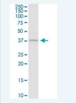 Caspase-4 Antibody (7G7), Novus Biologicals 100 &mu;g | Buy Online | Novus Biologicals | Fisher Scientific