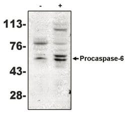 Caspase-6 Antibody (MCH2 14 1-190), Novus Biologicals 100&mu;g:Antibodies,