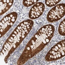 Caspase-6 Antibody, Novus Biologicals 0.1 mL; Unconjugated:Antibodies,