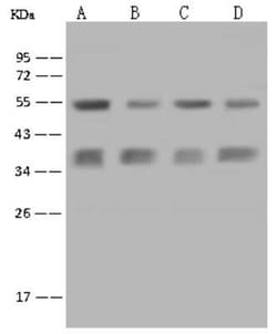Caspase-6 Antibody, Novus Biologicals:Antibodies:Primary Antibodies