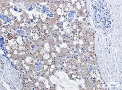 Catalase Antibody (S01-8B2), Novus Biologicals:Antibodies:Primary Antibodies
