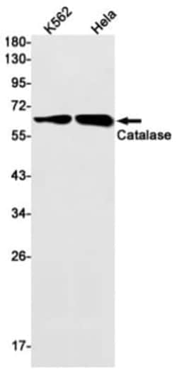 Catalase Antibody (S01-8B2), Novus Biologicals:Antibodies:Primary Antibodies