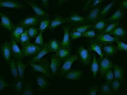 Cathepsin A/Lysosomal Carboxypeptidase A Antibody, Novus Biologicals 100