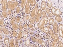Cathepsin A/Lysosomal Carboxypeptidase A Antibody, Novus Biologicals 100