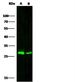 Cathepsin A/Lysosomal Carboxypeptidase A Antibody, Novus Biologicals:Antibodies:Primary