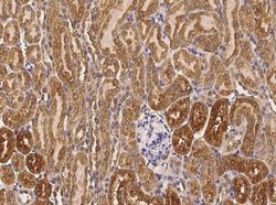 Cathepsin B Rabbit anti-Mouse, Clone: 10, Novus Biologicals 50 &mu;g; Unconjugated:Antibodies,