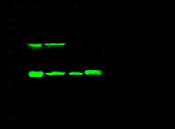 Cathepsin D Rabbit anti-Human, Clone: 10, Novus Biologicals:Antibodies:Primary