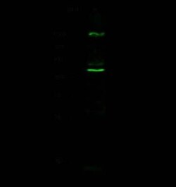 Cathepsin D Rabbit anti-Mouse, Clone: 102, Novus Biologicals:Antibodies:Primary