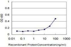 Cathepsin D Antibody (3F12-1B9), Novus Biologicals 0.1 mg | Buy Online | Novus Biologicals | Fisher Scientific