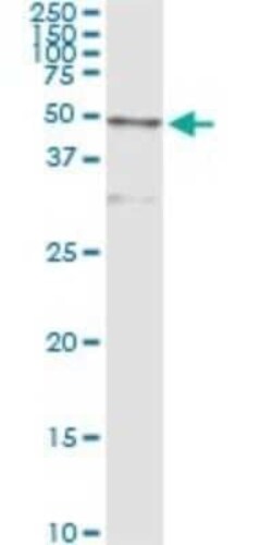 Cathepsin D Antibody (3F12-1B9), Novus Biologicals 0.1 mg | Buy Online | Novus Biologicals | Fisher Scientific