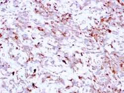 Cathepsin K Antibody (CTSK/2791) - Azide and BSA Free, Novus Biologicals