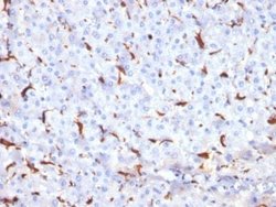 Cathepsin K Antibody (CTSK/2791) - Azide and BSA Free, Novus Biologicals