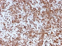 Cathepsin K, Mouse anti-Human, Clone: CTSK/2792, Novus Biologicals 20 ug;