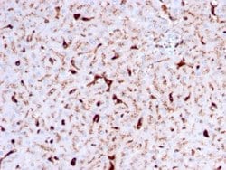 Cathepsin K, Mouse anti-Human, Clone: CTSK/2792, Novus Biologicals 20 ug;