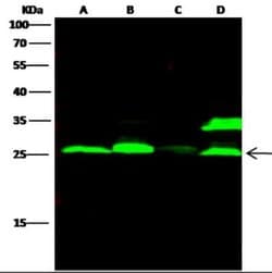 Cathepsin L Rabbit anti-Human, Clone: 221, Novus Biologicals:Antibodies:Primary