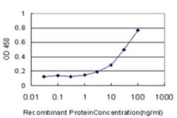 Cathepsin W Antibody (4A8), Novus Biologicals 0.1 mg | Buy Online | Novus Biologicals | Fisher Scientific