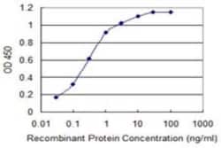 Cav1.2 Antibody (4D10), Novus Biologicals 0.1 mg, Unconjugated:Anticuerpos