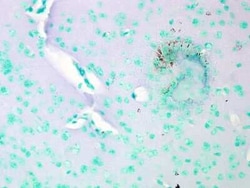 Cav1.2 Antibody (S57), Novus Biologicals 0.1 mg; Unconjugated:Anticuerpos