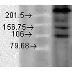 Cav1.2 Antibody (S57), Novus Biologicals 0.1 mg; Unconjugated:Anticuerpos