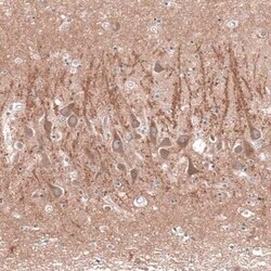 Cav3.2 Antibody, Novus Biologicals 25 &mu;L | Buy Online | Novus Biologicals | Fisher Scientific