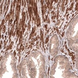 Cav3.2 Antibody, Novus Biologicals 25 &mu;L | Buy Online | Novus Biologicals | Fisher Scientific