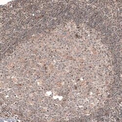 Cav3.2 Antibody, Novus Biologicals 25 &mu;L | Buy Online | Novus Biologicals | Fisher Scientific