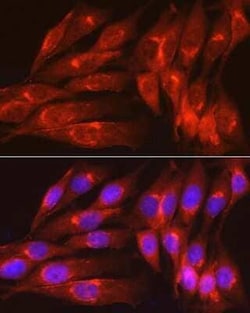 Caveolin-1 Rabbit anti-Human, Mouse, Rat, Clone: 9I9J8, Novus Biologicals 100 &mu;g | Buy Online | Bio-Techne | Fisher Scientific