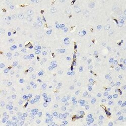 Caveolin-1 Rabbit anti-Human, Mouse, Rat, Clone: 9I9J8, Novus Biologicals 100 &mu;g | Buy Online | Bio-Techne | Fisher Scientific