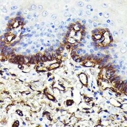 Caveolin-1 Rabbit anti-Human, Mouse, Rat, Clone: 9I9J8, Novus Biologicals 100 &mu;g | Buy Online | Bio-Techne | Fisher Scientific