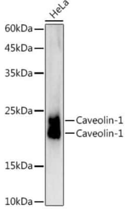 Caveolin-1 Rabbit anti-Human, Mouse, Rat, Clone: 9I9J8, Novus Biologicals 100 &mu;g | Buy Online | Bio-Techne | Fisher Scientific