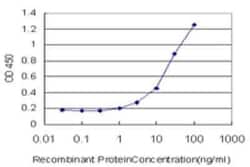 Caveolin-3 Antibody (1G11), Novus Biologicals 0.1 mg | Buy Online | Novus Biologicals | Fisher Scientific