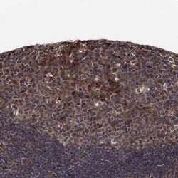 Cdc23 Antibody, Novus Biologicals:Antibodies:Primary Antibodies