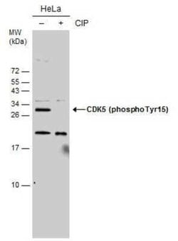 Cdk5, p Tyr15 Antibody, Novus Biologicals 100 &mu;g; Unconjugated:Antibodies,