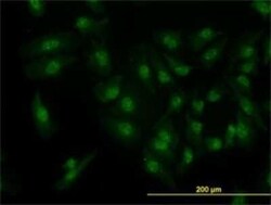 Cdk6 Antibody (8H4), Novus Biologicals 0.1 mg | Buy Online | Novus Biologicals | Fisher Scientific