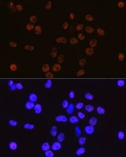 Cdk9 Rabbit anti-Human, Mouse, Rat, Clone: 1C4E3, Novus Biologicals 100