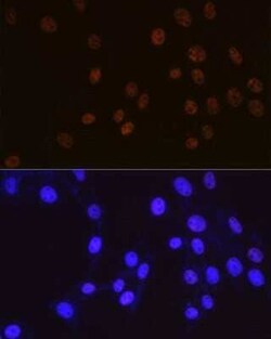 Cdk9 Rabbit anti-Human, Mouse, Rat, Clone: 1C4E3, Novus Biologicals 100