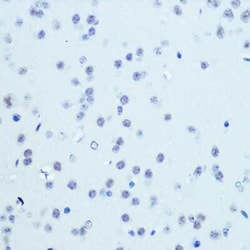 Cdk9 Rabbit anti-Human, Mouse, Rat, Clone: 1C4E3, Novus Biologicals 100