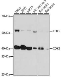 Cdk9 Rabbit anti-Human, Mouse, Rat, Clone: 1C4E3, Novus Biologicals 100